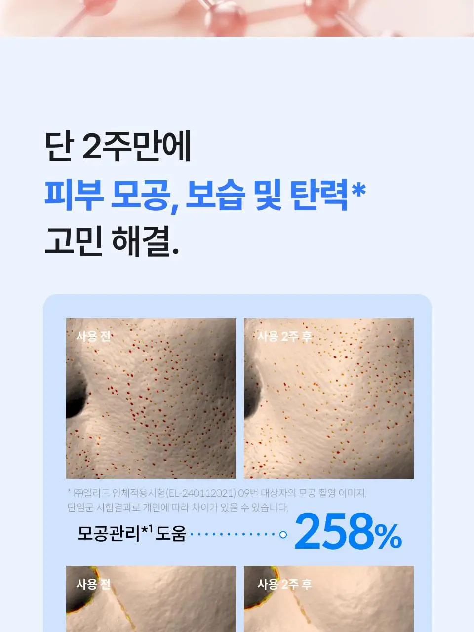 [모공 탄력 뷰티디바이스] 반코르 리리힐 고주파 마사지기 (+기미&잡티케어 세럼 증정) 상세페이지 14